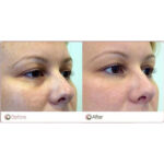 سرم دورچشم ضد تیرگی و پف کافئین اوردینری - تصویر 3