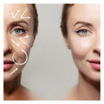 کپسول هیالورونیک اسید مای ویتامینز 30 تایی - تصویر 3