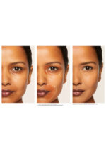 کورکتور نارس - تصویر 5