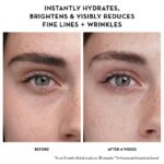 کرم دور چشم اوله هنریکسن - تصویر 4