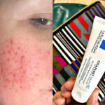 کرم ترمیم کننده سیکاپلاست لاروشه پوزای - تصویر 3