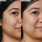 سرم درخشان کننده هندوانه گلو رسیپی Glow Niacinamide Dew Drops - تصویر 9