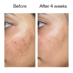 سرم آبرسان و تقویت کننده سد دفاعی پوست اینکی لیست Ectoin Hydro-Barrier Serum - تصویر 3